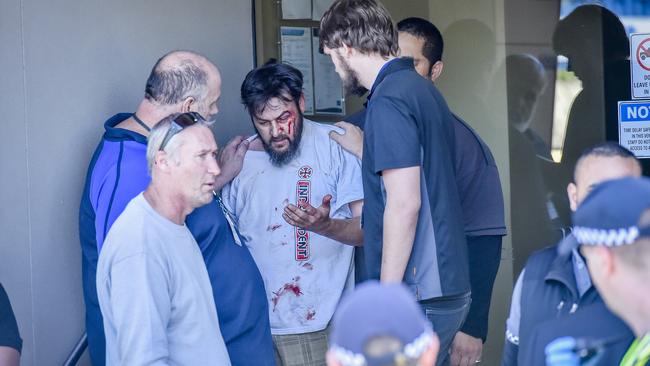 A bloodied man awaits medical treatment. Picture: Jason Edwards