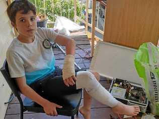 SORE AND SORRY: Jeremy Harvey, 13, was viciously attacked by two pit bulls at Proston on Saturday night. Picture: Contirbuted