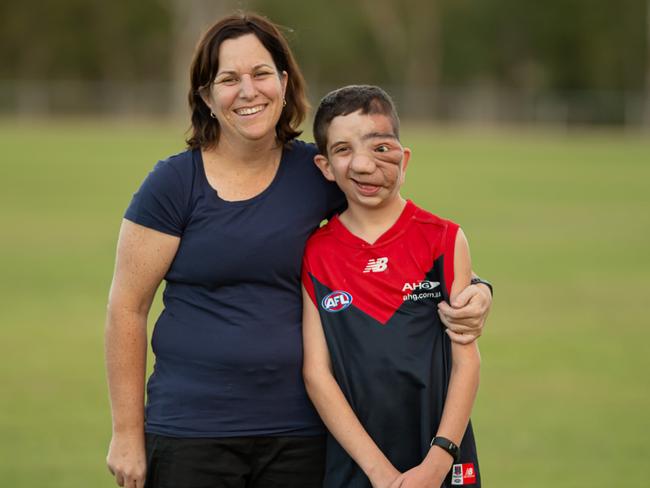 Nicholas Daisley with mum Dannielle. Picture: Steve Vit