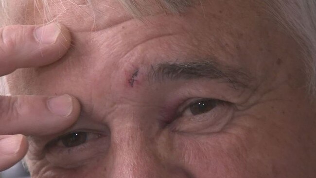 Baker David Winter was allegedly assaulted by a contractor outside his business. Picture: Nine News