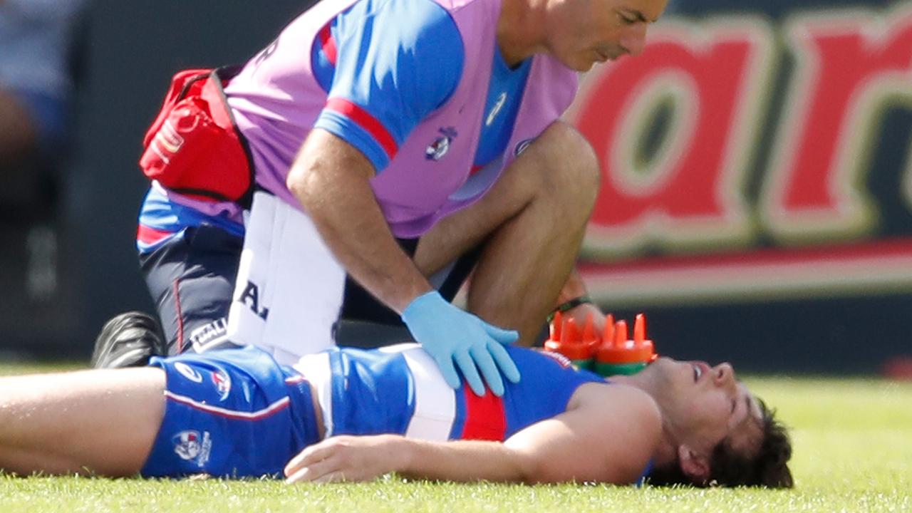 BALLARAT, AUSTRALIA – MARCH 03: Liam Picken of the Bulldogs lies on the field injured during the AFL JLT Community Series match between the Western Bulldogs and the Hawthorn Hawks at Mars Stadium on March 3, 2018 in Ballarat, Australia. (Photo by Scott Barbour/Getty Images)