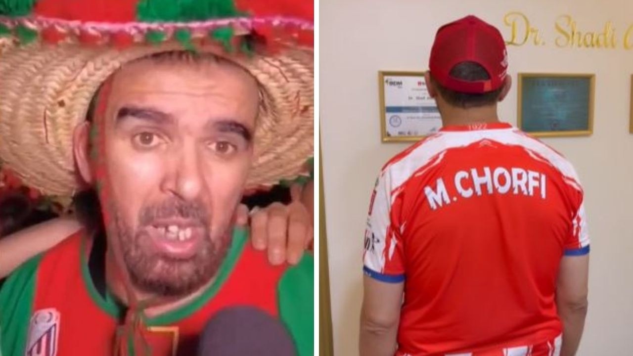 World Cup fan bullied over bad teeth undergoes dramatic transformation