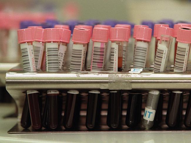 27 jul 1999 Blood Bank -  test tubes of blood samples ready for testing - a young girl has been given HIV / AIDS contaminated donor blood during a transfusion - medical red cross VIC