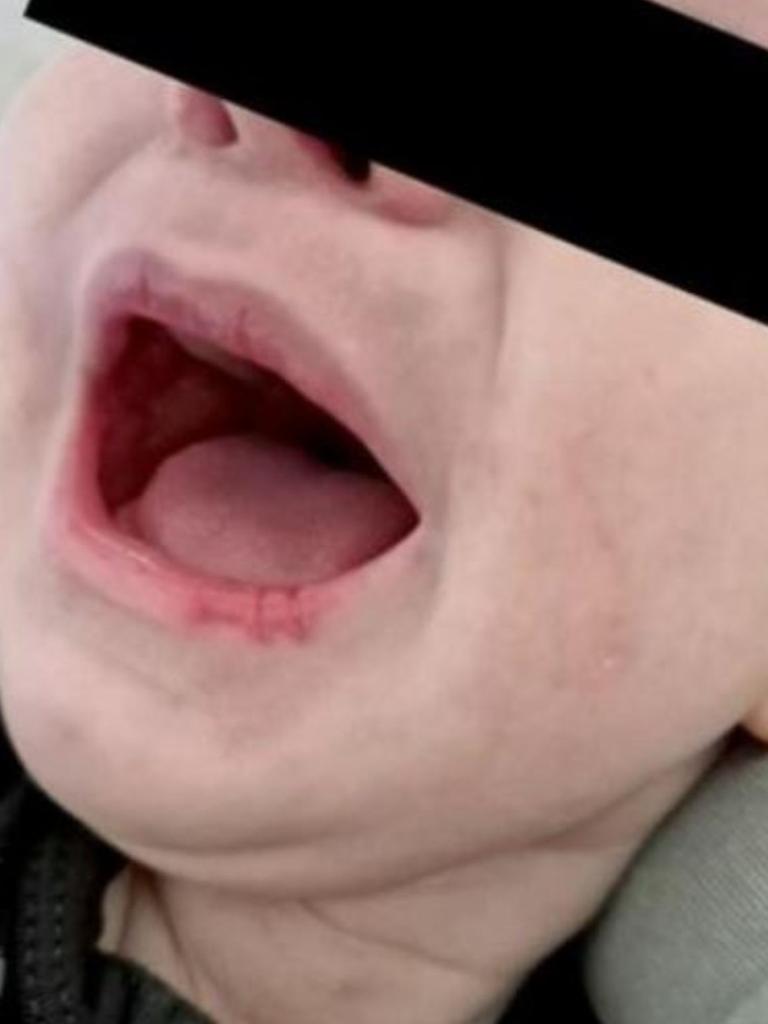 The boy was left malnourished with cracked lips. Picture: 7NEWS