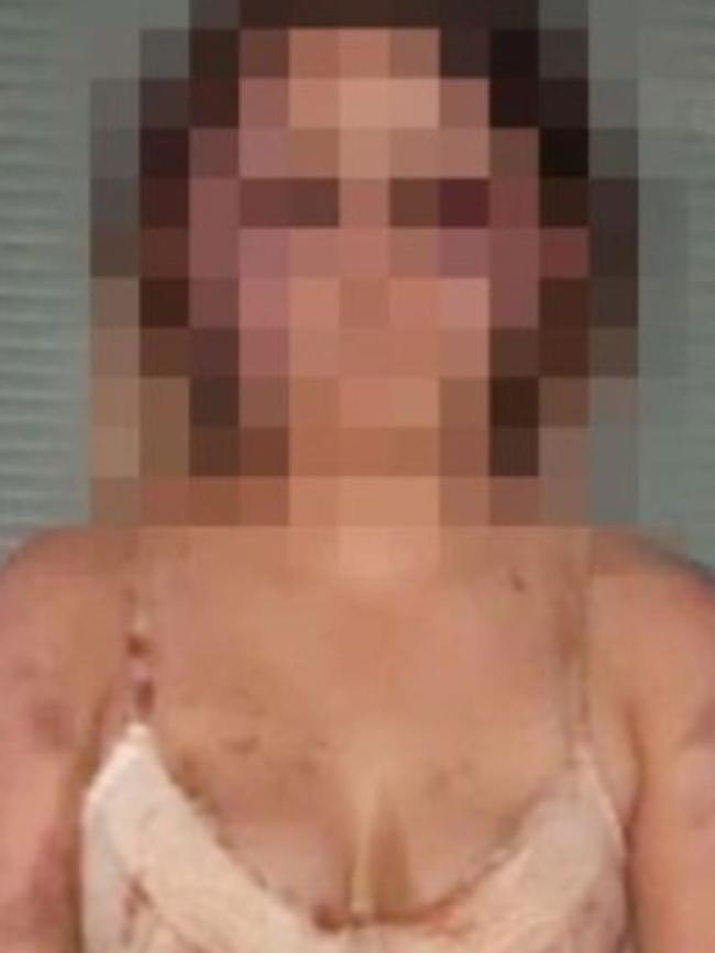 The 13-year-old victim was allegedly tortured for four hours. Picture: Supplied