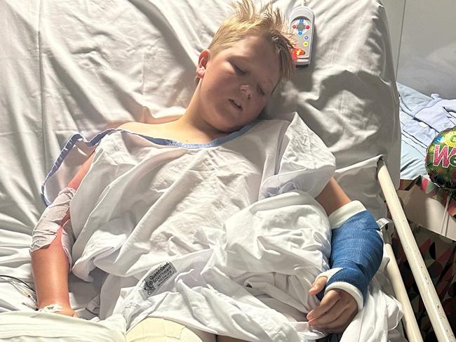 Jett McBean was injured in an e-scooter crash in Airlie Beach on 17 January 2024. Photo: Contributed