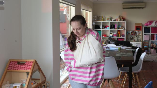 Erin Geer was injured in her home when a piece of glass lodged in her arm as the wind swept through the house breaking windows. Picture: Peter Ristevski