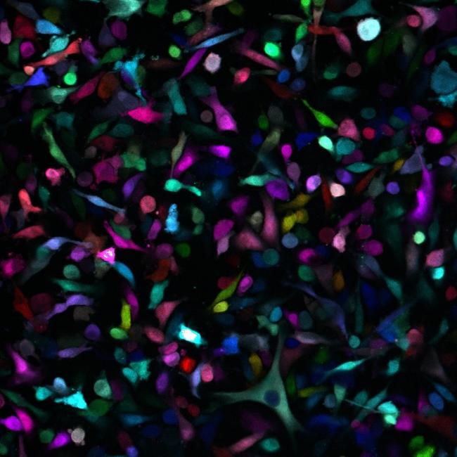 Cancer cell populations from local breast tumours are traced using fluorescent markers in the ACRF Centre for Imaging the Tumour Environment. Researcher: Dr Jean Berthelet, ONJCRI.