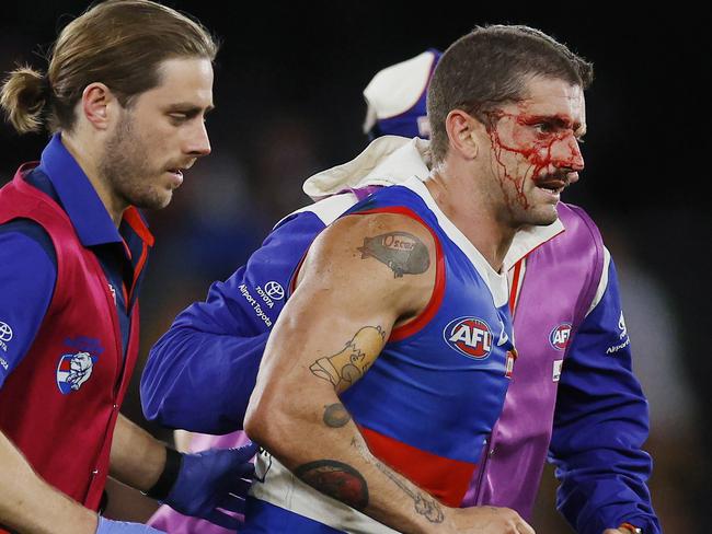 MELBOURNE , AUSTRALIA. May 4, 2024.  AFL Round 8. . Western Bulldogs vs Hawthorn at Marvel Stadium.   Bulldog Tom Liberatore heads to the bench after copping an accidental boot in the heads in the dying minutes   . Pic: Michael Klein