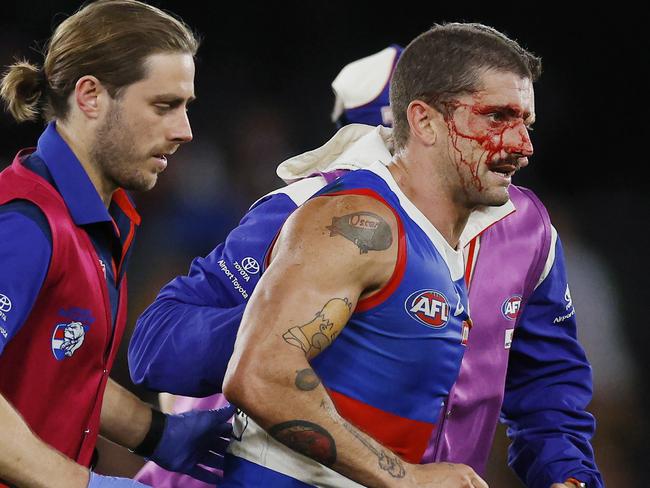 ‘Indefinite’ absence for Bulldogs star