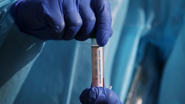 A nurse holds a COVID-19 swab test ready for processing at a Bondi Beach drive-through testing clinic on July 22, 2020. Picture: Lisa Maree Williams/Getty