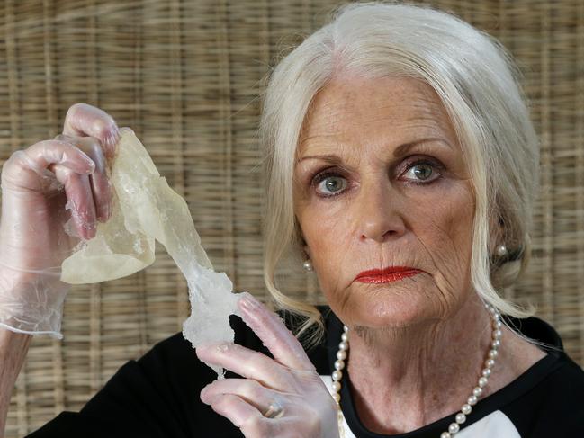 Barbara Stanistreet from St Kilda had breast implants 32 years ago and they made her incredibly ill. Picture: Ian Currie