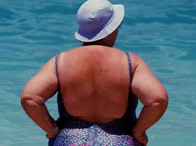 Generic rear view photo of obese woman at the beach.People / Fat / Situation  Z-Migr-AllFuturePic