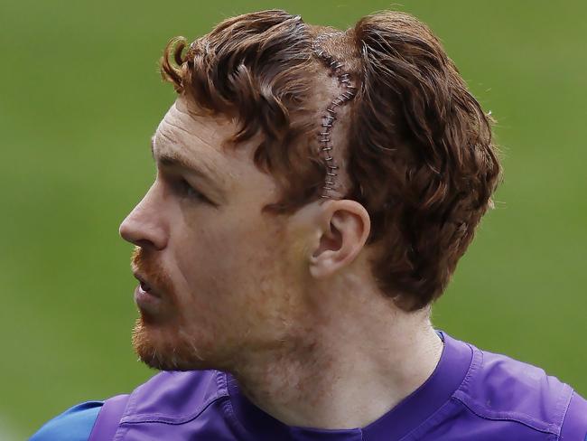 NCA. MELBOURNE, AUSTRALIA. September 16 , 2024. Geelong training at GMNBA Stadium, Geelong.  Gary Rohan of the Cats with a head full of staples after operation to fix a fracture in his scull  during todays session   . Pic: Michael Klein