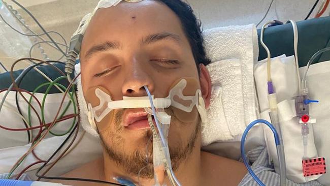 Juan Jimenez, 25, came to Australia for a new life but is now facing piling debt and crippling pain following a severe workplace accident. Picture: Supplied