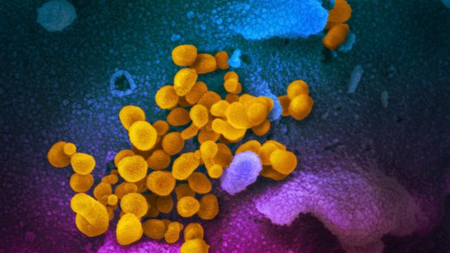 A scanning electron microscope shows SARS-CoV-2 (yellow), the virus that causes COVID-19, isolated from a patient in the US, emerging from the surface of cells (blue/pink) cultured in the lab. Picture: AFP