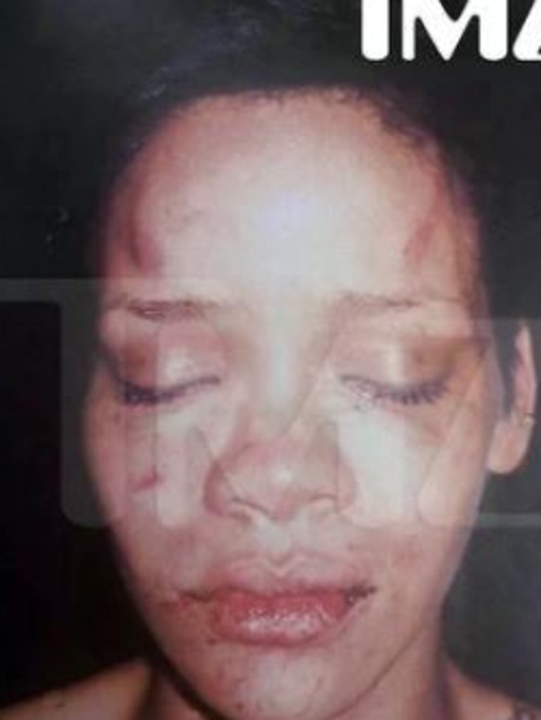 The picture released of pop star Rihanna on the night in question. Picture: AP