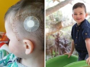 Boy’s regression a sign of brain tumour