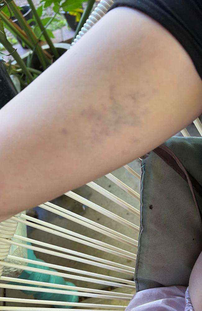 A teenage girl was allegedly assaulted in Boyne Island on Saturday, June 29. Picture: Contributed