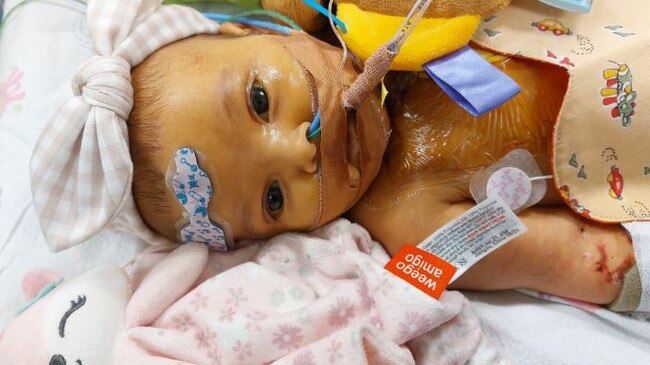 Raevyn Harper in hospital. Picture – GoFundMe.