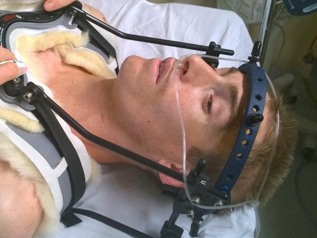 Steve Plain in halo brace after surfing accident. Source: Facebook/Steve Plain