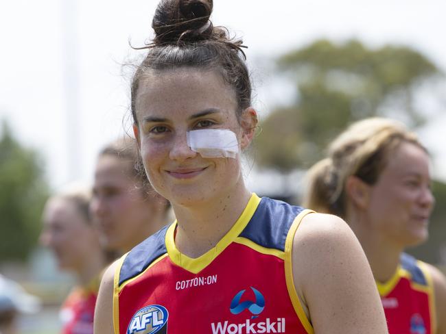 Eloise Jones needed stitches, but otherwise, the Crows came away from their trial game loss to GWS at Richmond Oval unscathed. Picture: AAP/EMMA BRASIER