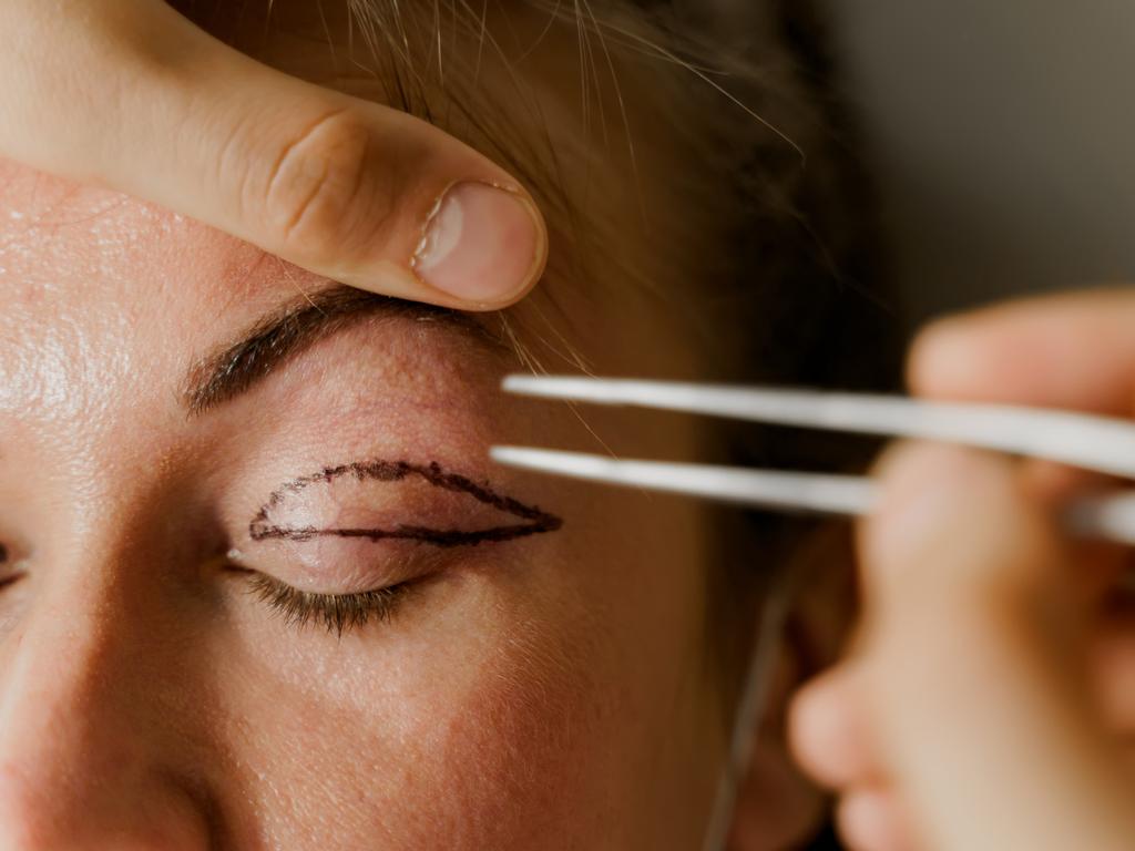 Blepharoplasty – an operation that repairs drooping eyelids – is not covered by Medicare or private health unless it’s to correct vision loss. Picture: iStock.