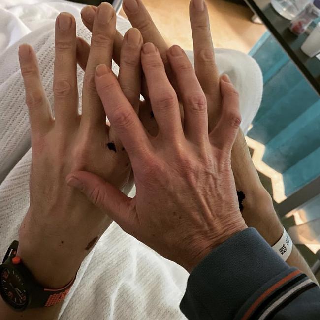 Samuel Johnson's sister posted a picture of the actor’s injured hands.