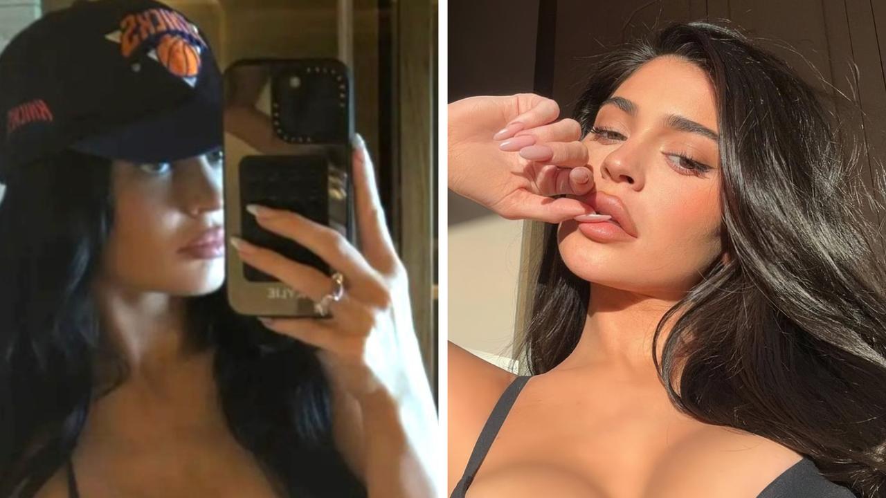 Kylie’s detailed cosmetic surgery confession