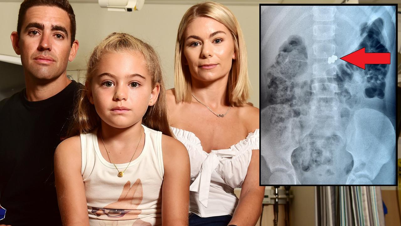 Townsville Girl Swallows Magnetic Balls Toy Banned In Australia