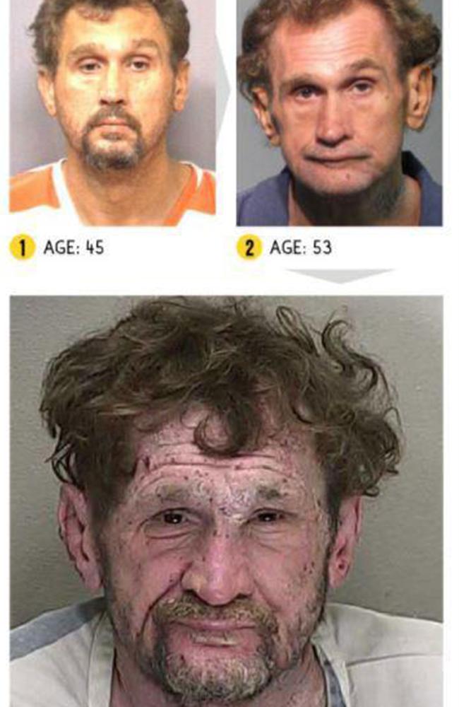 Drug Addiction Before And After Photos Show Shocking Reality Of Addicts News Com Au