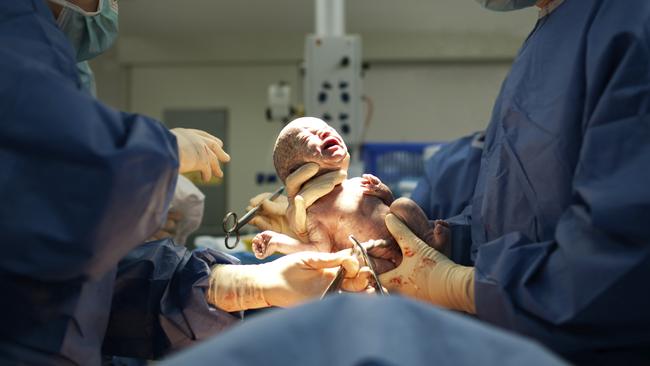 The same doctor who performed the surgical sterilisation coincidentally helped to deliver the woman’s baby via a caesarean