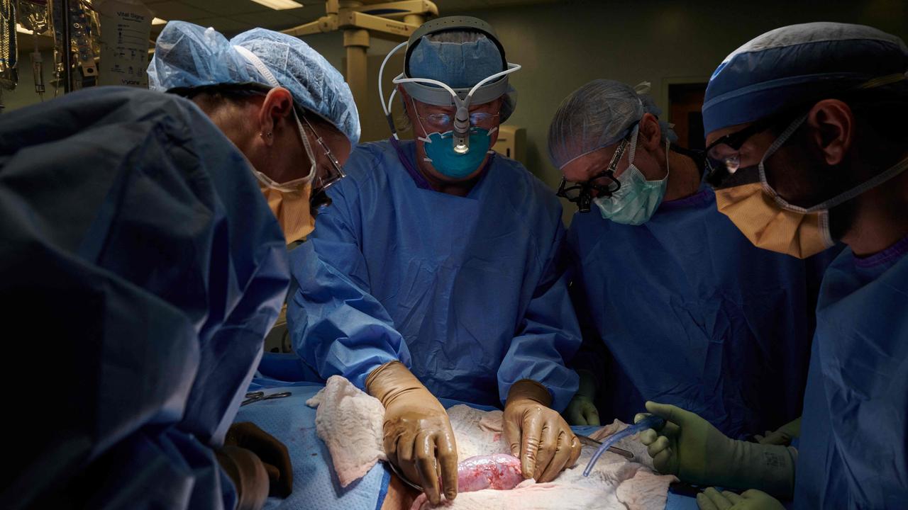 Surgeons at NYU Langone Health have successfully transplanted a pig kidney into a human. Picture: AFP / Joe Carrotta for NYU Langone Healt