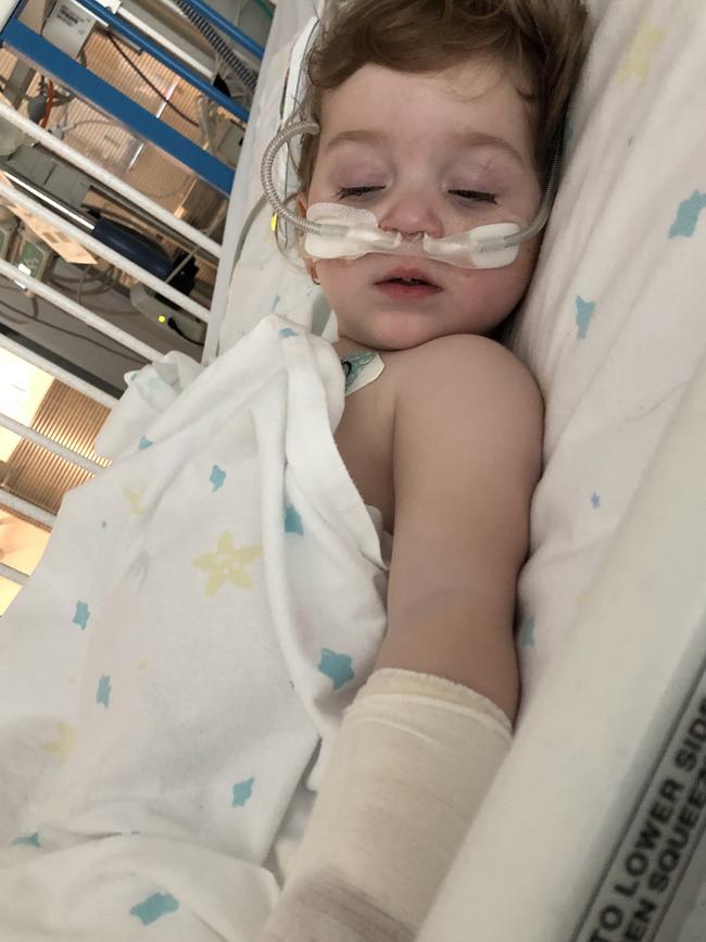 Belinda Seery's daughter Emilia, 17 months, recovering in hospital. Picture: supplied