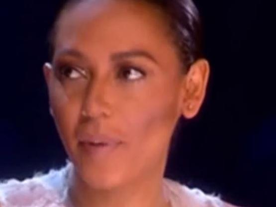 Mel b X Factor bruisesannettepix