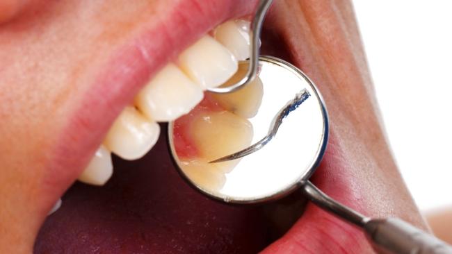 There is no end in sight for the painful boardroom feud at Gold Coast-based dental roll-up Smiles Inclusive.