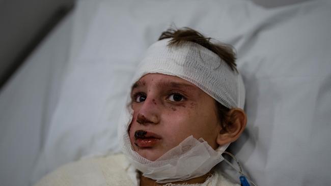 BEIRUT, LEBANON - OCTOBER 7: 11-year-old Mohammed from Ayn al-Dilib lies in bed at Geitaoui Hospital after receiving serious injuries in an Israeli airstrike, on October 7, 2024 in Beirut, Lebanon. Hundreds of thousands of people have fled Lebanon in recent weeks, as Israel has ramped up its attacks on Hezbollah, the Iran-backed militant and political group. Israel is conducting daily airstrikes in the capital and elsewhere in the country, while expanding its ground operation in the south. (Photo by Carl Court/Getty Images)