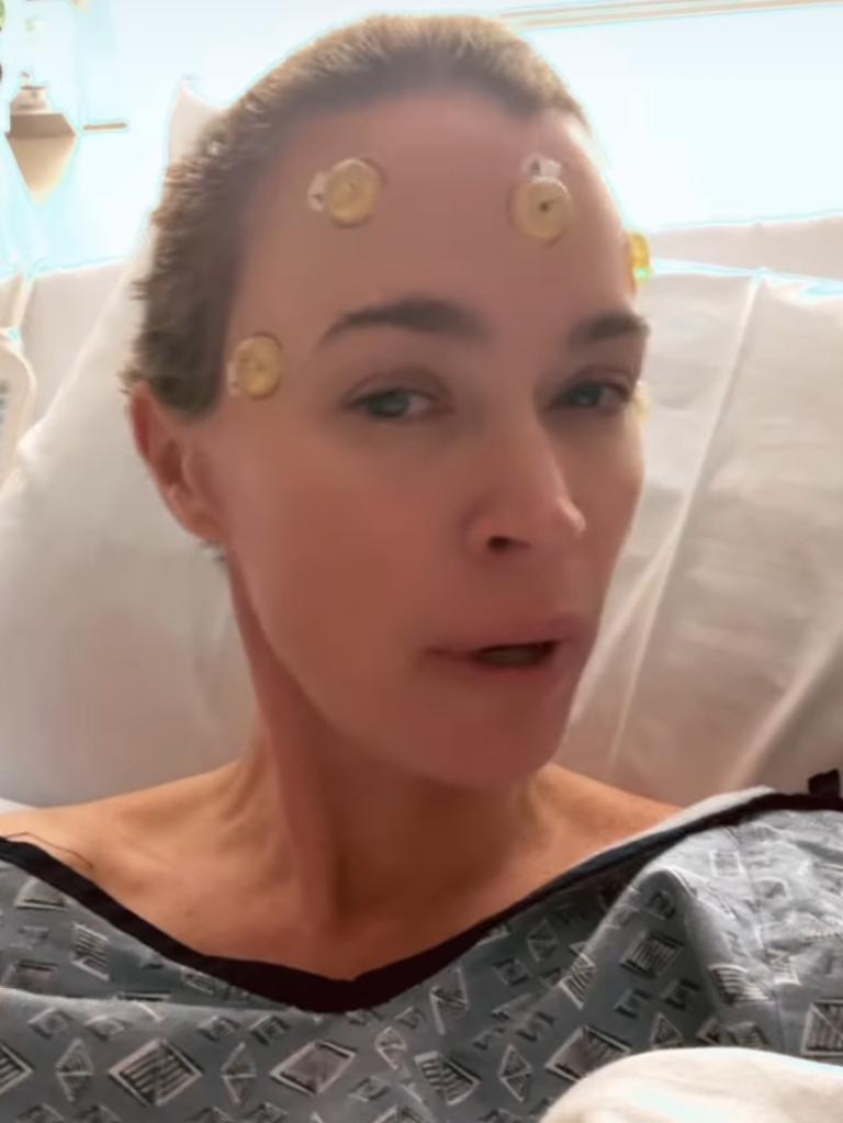 The reality star revealed her shaved head ahead of the surgery.