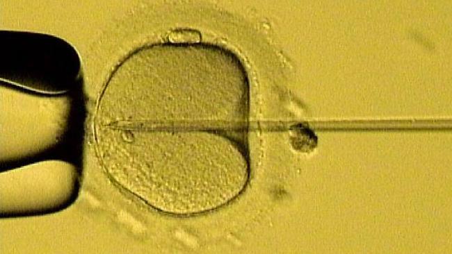 An image of a needle containing a sperm being injected into a female egg. pic/supplied/IVF/South. / Medical childbirth science embryos