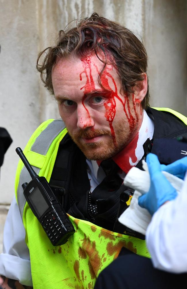 A Police officer receives medical attention after Police clashed with demonstrators in Whitehall during a Black Lives Matter protest in London. Picture: Reuters