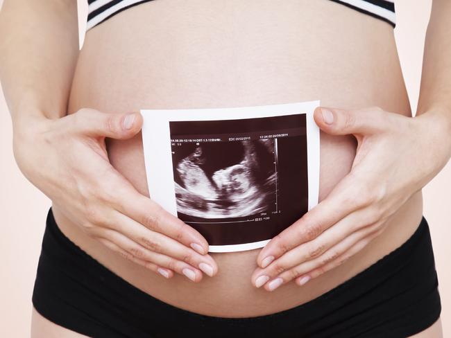 Gestational diabetes is strongly linked to risk factors. including a previous history. Picture: iStock