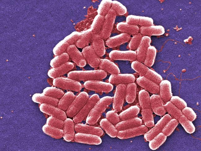 This 2006 colorized scanning electron micrograph image made available by the Centers for Disease Control and Prevention shows the O157:H7 strain of the E. coli bacteria. Bacteria with a special type of resistance to antibiotics have been found for a second time in the U.S., increasing worries that the country will soon see a superbug that cannot be treated with known medications. This case, first reported in a medical journal Monday, July 11, 2016, occurred a year earlier in New York. (Janice Carr/CDC via AP)