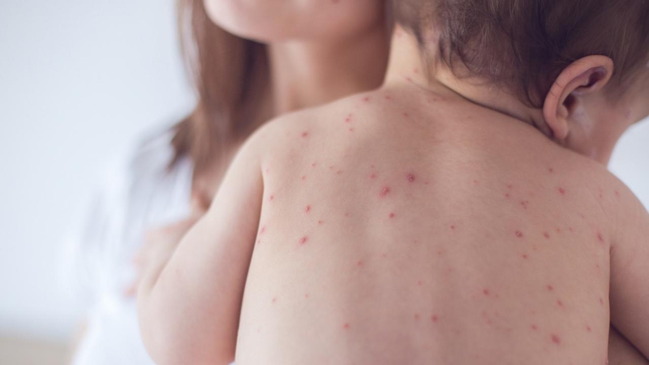 Provocate consulting group founder Troy Bilsborough said governments may need to adopt a “Chickenpox strategy” which is to tell parents that it’s better to catch it when you’re young than old. Picture: iStock