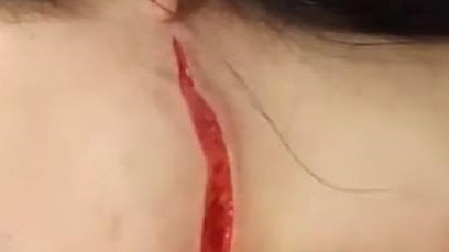 A 16-year-old girl was cut from ear to chin with a box cutter during a brawl at Kawana Shoppingworld in 2020.