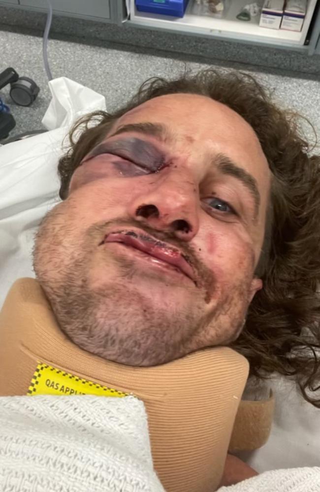 Brisbane father Josh Jones, who was left hospitalised after being allegedly assaulted at a junior rugby league game. Picture: Supplied