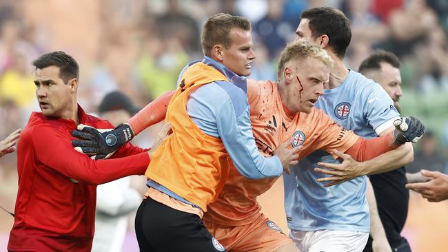 A bleeding Tom Glover of Melbourne City is escorted from the pitch. Picture: Getty