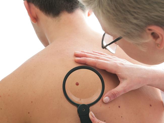 Dermatologist examines a mole of male patient