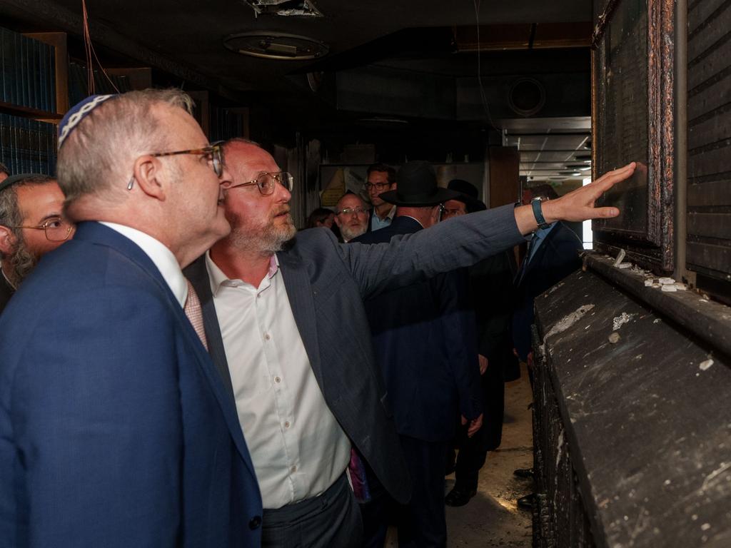 Albanese ‘emotional, in shock’ after synagogue visit