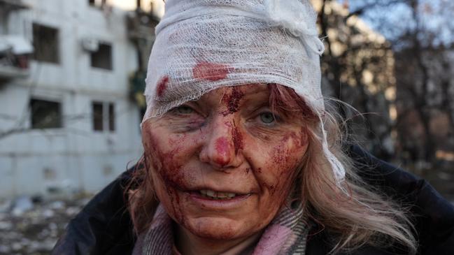 A wounded woman is seen as air strike damages an apartment complex outside of Kharkiv. Picture: Wolfgang Schwan/Anadolu Agency via Getty Images