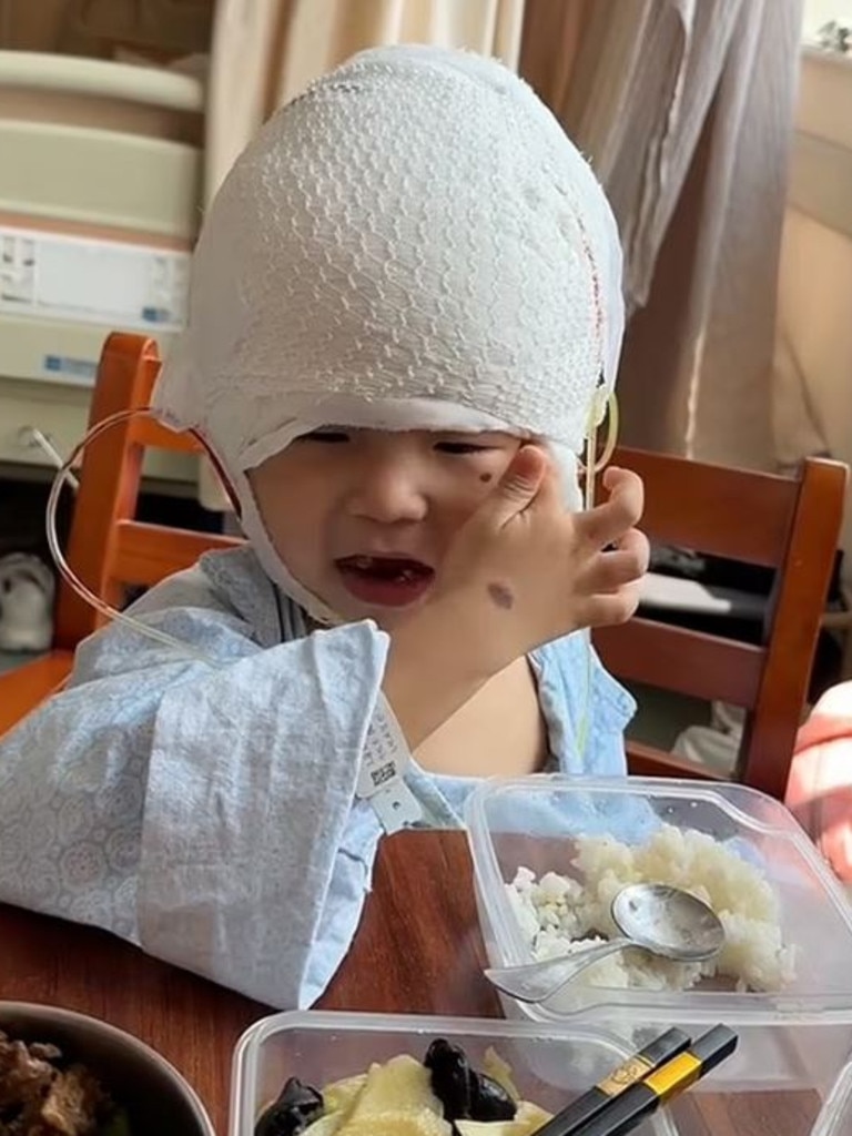 Five months later, his transformation is extraordinary. Picture: AsiaWire